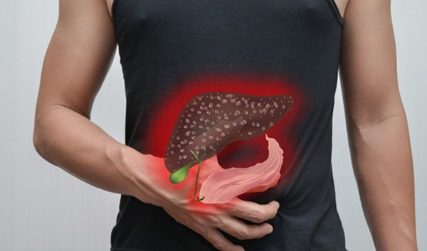 Đau và sưng bụng là một trong những dấu hiệu của ung thư gan giai đoạn đầu